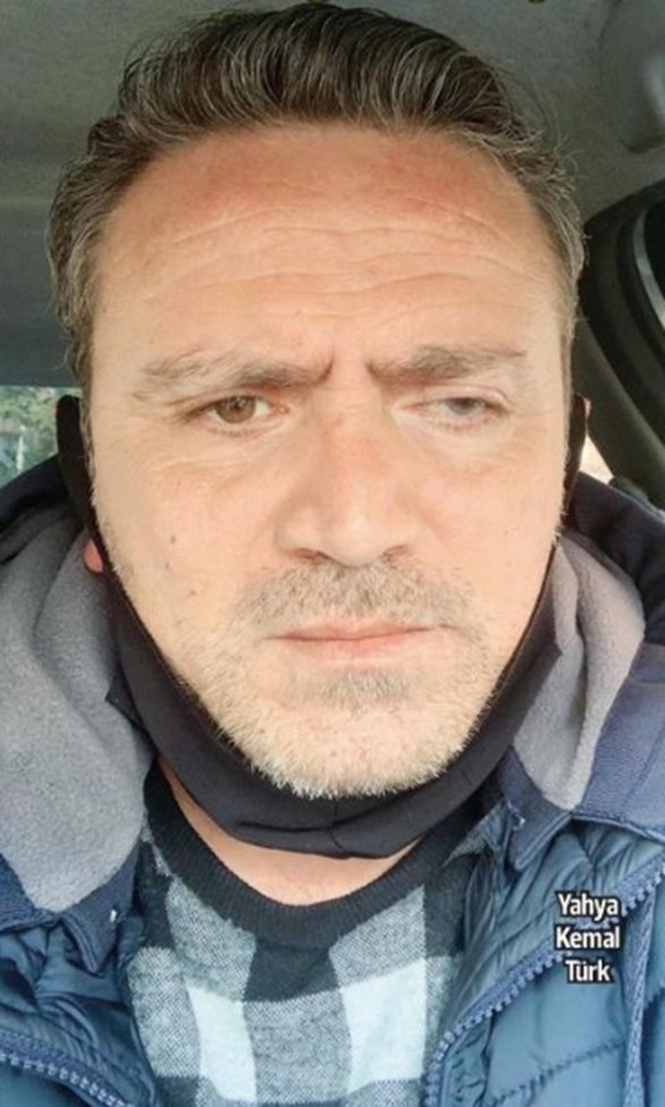 Hatalı ameliyatla gözünü kaybetti!