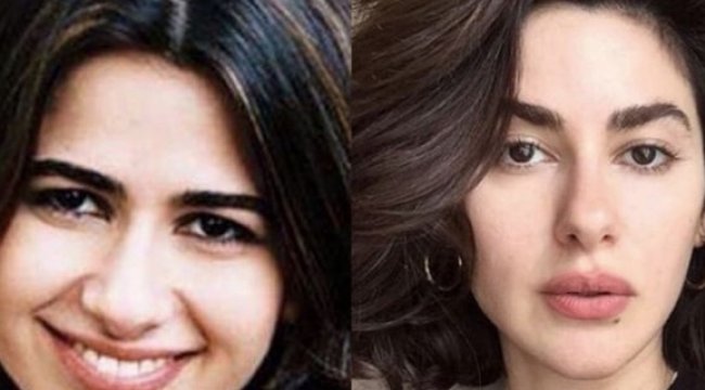 Nesrin Cavadzade'den 'estetikli' iddiasına yanıt!