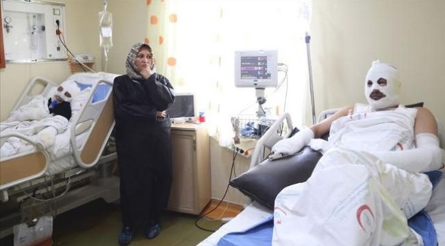 Gaz kaçağını çakmakla kontrol eden çift hastanelik oldu