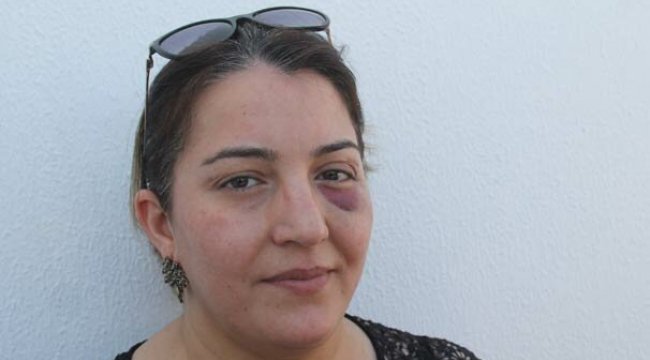 Çarptığı yaralıya müdahale eden sağlıkçı darp edildi