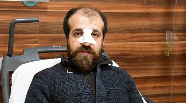 DOKTORA SALDIRAN İKİ KİŞİ TAHLİYE EDİLDİ  UYARISI