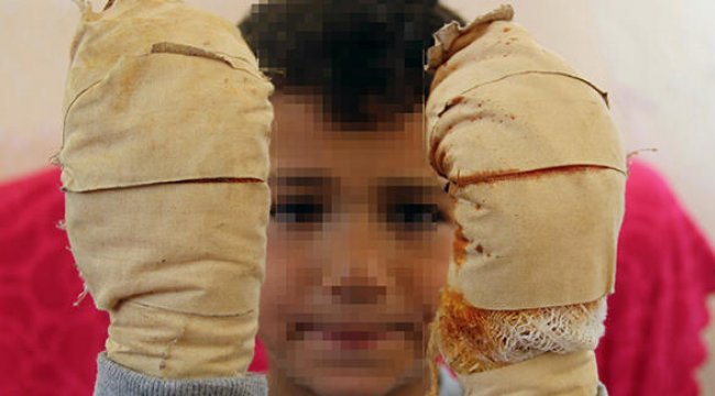 Komşu çocuğu, küçük Efe’ye dehşeti yaşattı