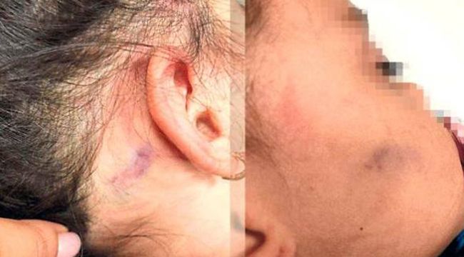 BUCA'DA ANAOKULUNDA FECİ OLAY!