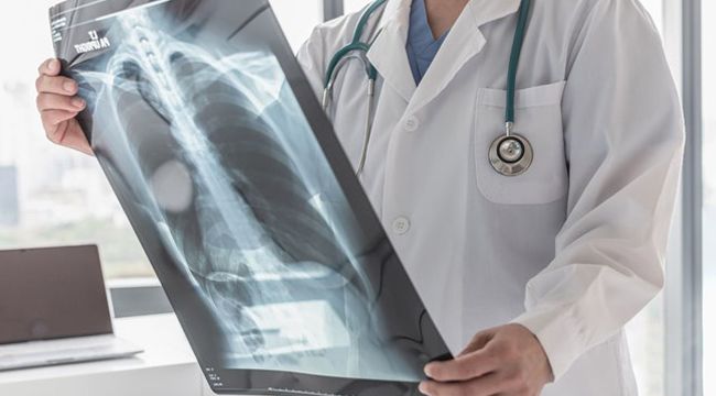 Pulmoner hipertansiyon (KTEPH) nasıl tedavi edilir?