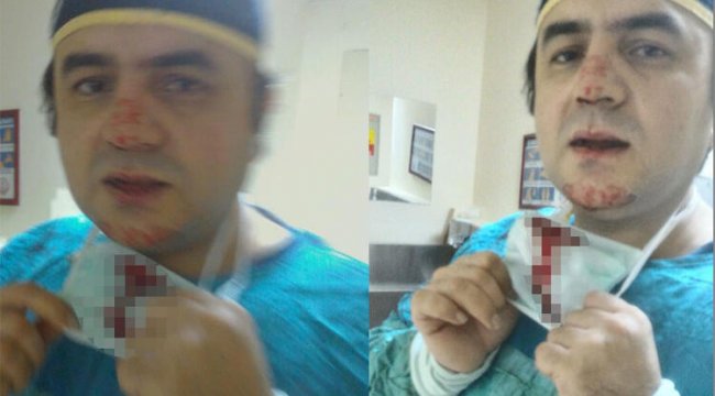 Doktor saldırganın eşine bu halde doğum yaptırdı!