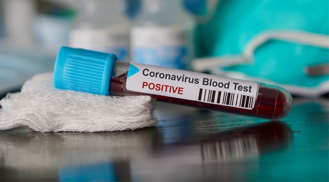 Hırvatistan ve Avustrurya'da koronavirüs onaylandı