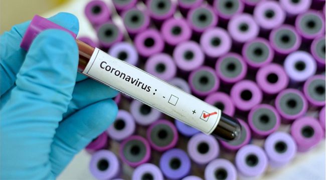 Koronavirüs İtalya'da can aldı