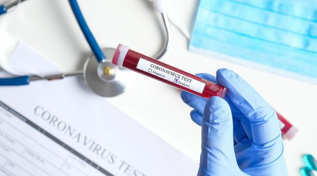İran'ın eski Vatikan Büyükelçisi koronavirüsten hayatını kaybetti