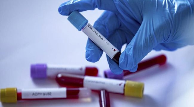 Bütün Valiliklerde eşzamanlı pandemi toplantısı