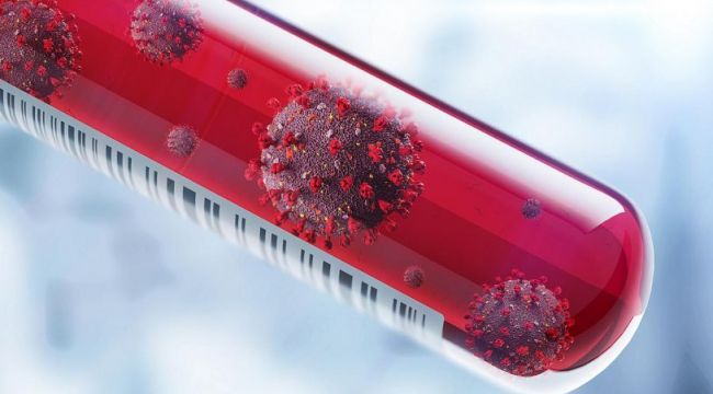 DÜNYA GENELİNDE CAN KAYBI 30 BİNİ AŞTI