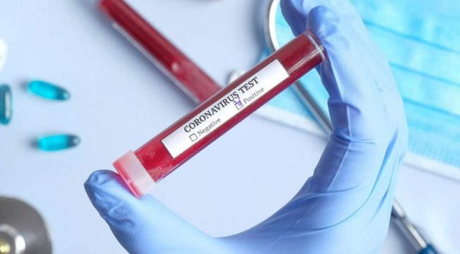 Evinde ölü bulunan kadında koronavirüs şüphesi