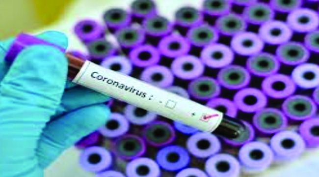 İZMİR'DE KORONAVİRÜS TESTİ YAPAN HASTANELER