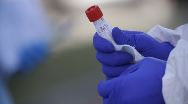 ABD'den koronavirüs kan testine onay