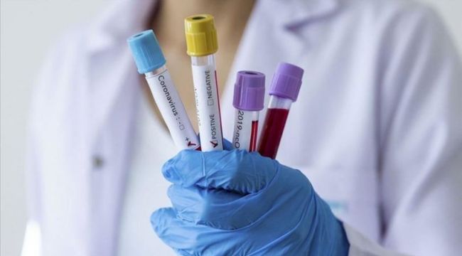 Almanya'da biri 36 yaşında 3 Türk daha hayatını kaybetti