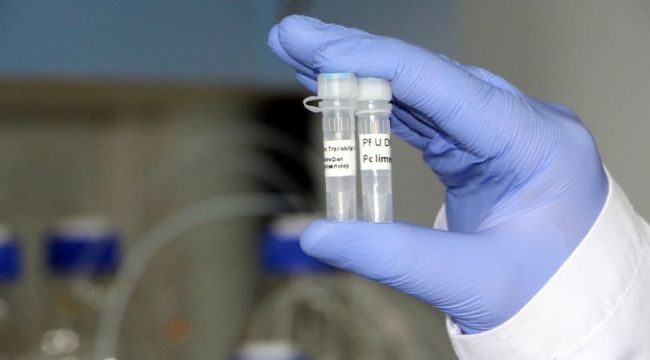 Bakan Pekcan'dan tanı kiti açıklaması