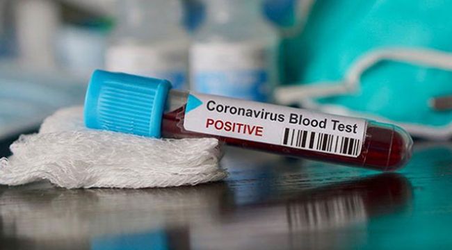 Bulgaristan’da vaka sayısı 1387’ye yükseldi