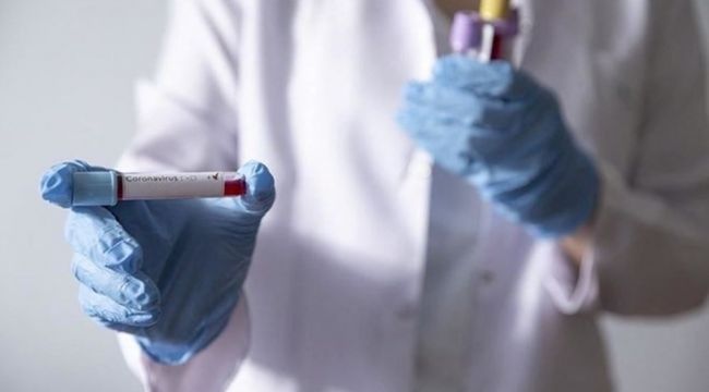 Corona virüs ölümlerinin sayısı kaydedilenden yüksek olabilir