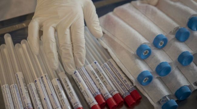 İngiltere, Çin'den bozuk çıkan test kitlerinin parasını geri istiyor