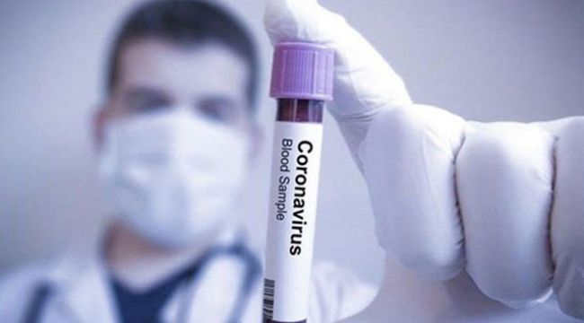 İsveç’te son 24 saatte koronavirüsten 107 ölüm