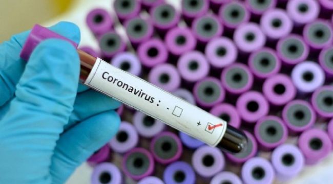 İZMİR'DE BİR HAFTADA 91 SAĞLIKÇI DAHA VİRÜSE YAKALANDI