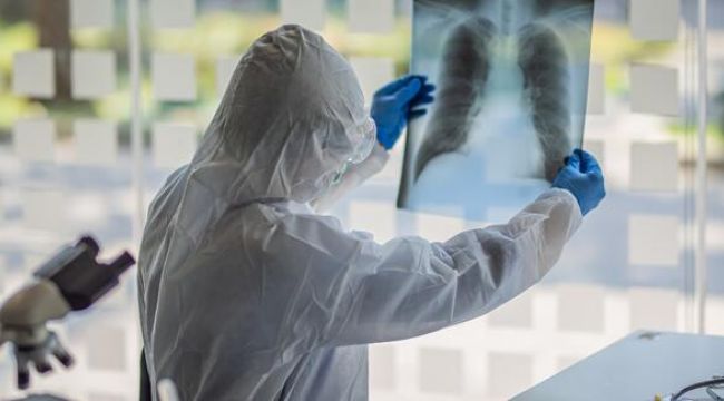  KORONAVİRÜSTE ORUCA DİKKAT