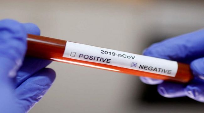 Koronavirüsten ölen bazı hastaların test sonucu nasıl negatif çıkıyor?