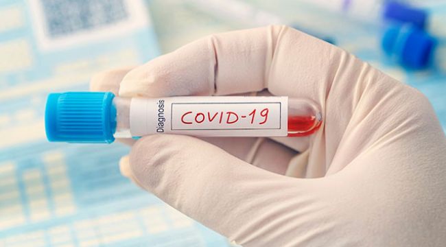 Şişli'de 5 bin 575 adet Covid-19 Test Kiti ele geçirildi