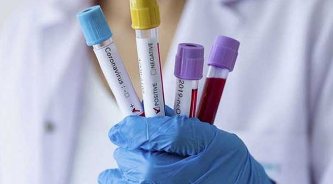 Yerli ilaç firması koronavirüs tedavisinde kullanılan ilacın üretimine başladı