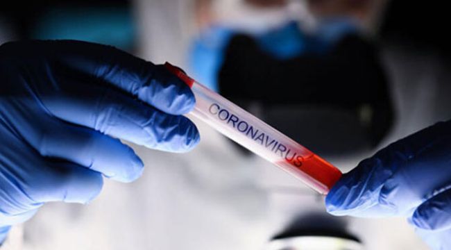 ABD’de koronavirüsten ölenlerin sayısı 85 bini geçti