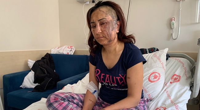 Boşanmak isteyen eşine kezzapla saldırdı