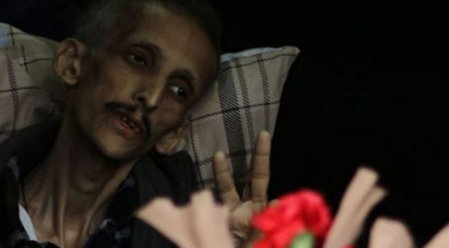 Haluk Levent,  Gökçek için Adalet Bakanlığı ile görüştü
