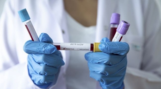 Koronavirüste örnek gösterilen ülkede 50 gün sonra sıçrama