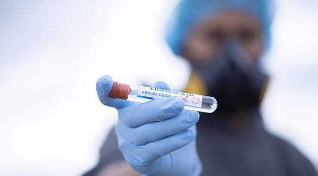 Rusya’da 8 bin 849 yeni koronavirüs vakası
