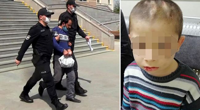 Üvey babasının işkencesine uğrayan çocuktan yürek burkan istek