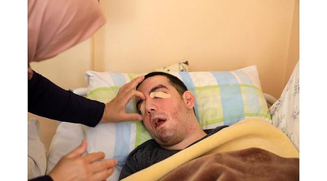 Yatalak oğlunun gözlerini 6 yıldır yara bandıyla kapatıyor