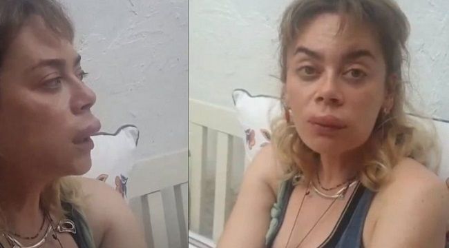 Demet Evgar’ın talihsiz günü