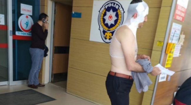 Fabrikada buhar hortumu patladı