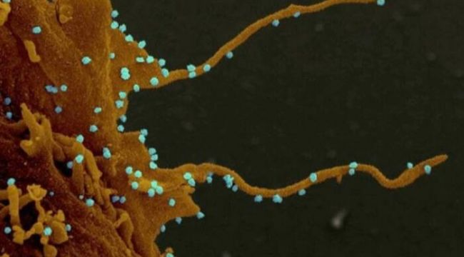 Bilim insanları koronavirüsün kollarını görüntüledi