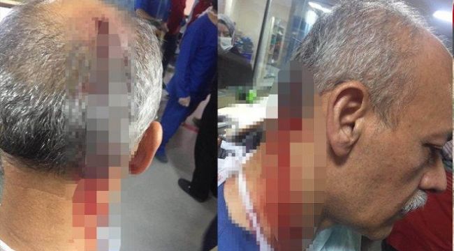 'Araba çarptı' iddiasıyla gittiği hastanede doktora saldırdı