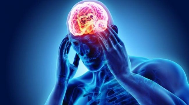Covid-19'da en sık görülen nörolojik bulgu baş ağrısı