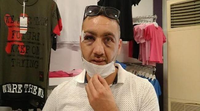 Maske uyarısı yapan mağaza müdürüne saldırı