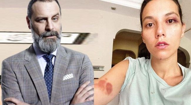Ozan Güven'in, şiddet içeren mesajları ortaya çıktı!