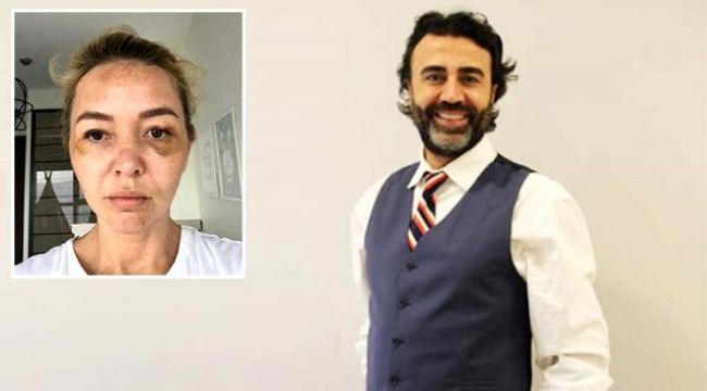 Sevgilisine şiddet uyguladığı iddialarına yanıt verdi !