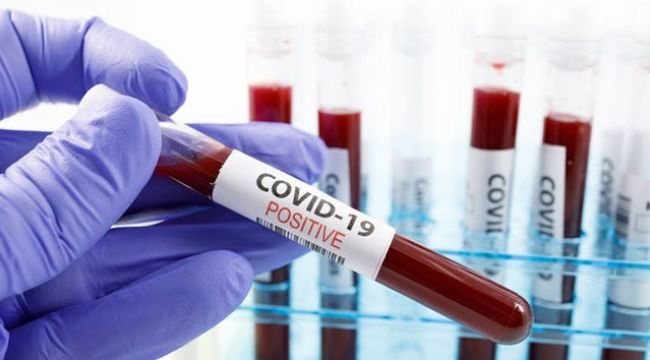Almanya'da Covid-19 testi skandalı