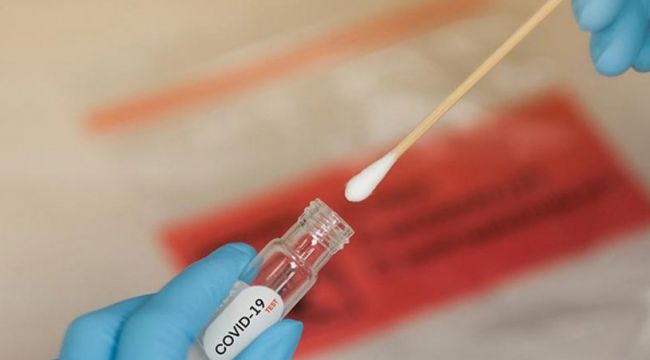 Kovid-19 testleri ile ilgili flaş iddia!