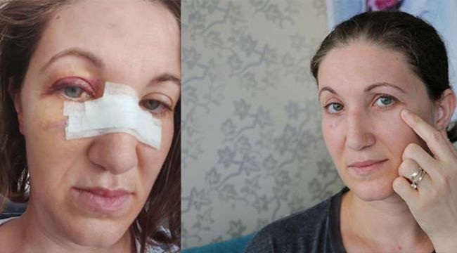 Gelinliği kirletip, kadın çalışanı darp ettiler