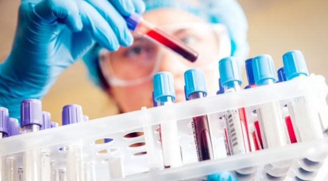 Sağlık Bakanlığı'nda yeni kriz iddiası