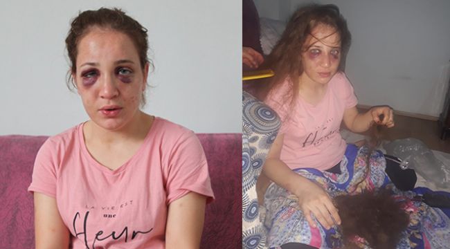 3 Çocuk annesi kadına düşmanca şiddet
