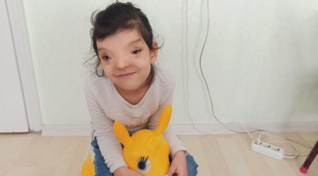 Dünyada sadece 4 kişide olan hastalık