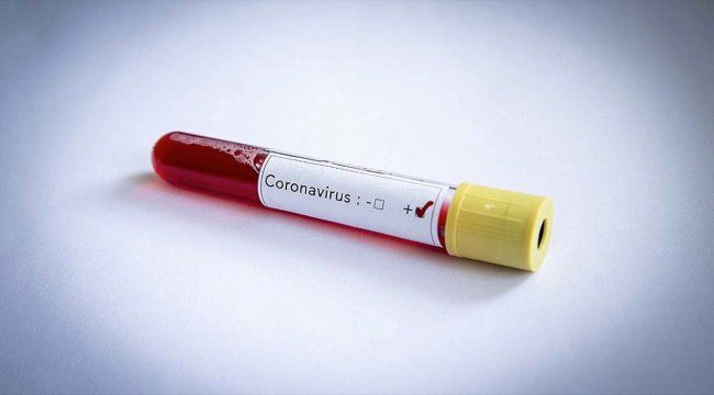 Türkiye Rus koronavirüs aşısının üretimine talip oldu